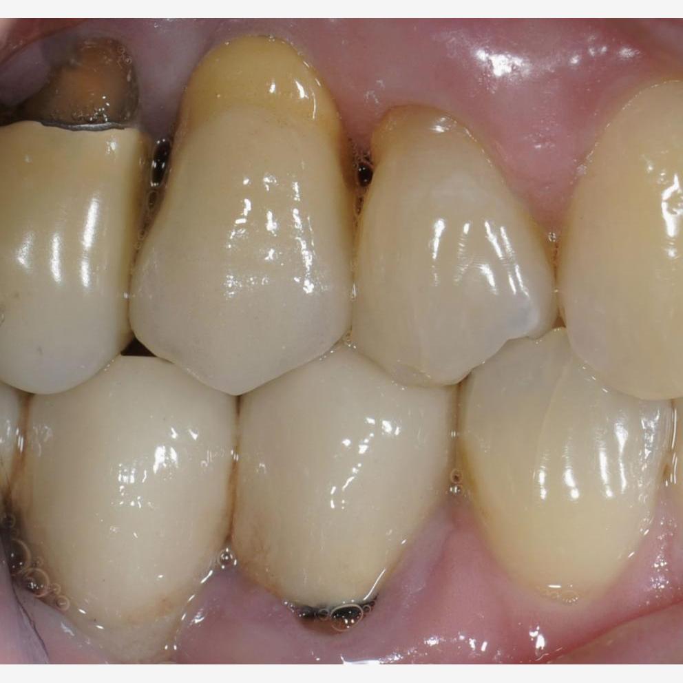 Chi è Che Costruisce Ponti D'argento E Corone D'oro
